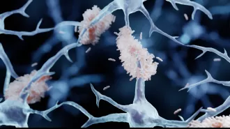 New potential treatment for Alzheimer's disease using nasal spray to remove harmful proteins from the brain.