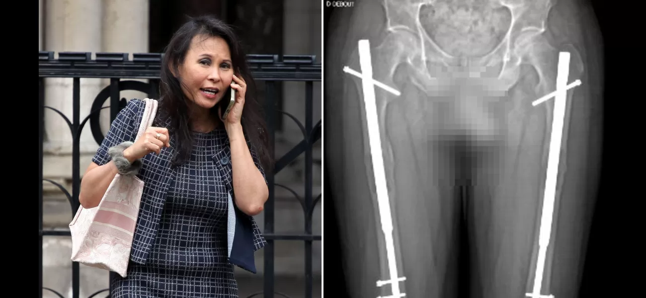 Banker files £1 million lawsuit over surgery that resulted in uneven leg lengths.