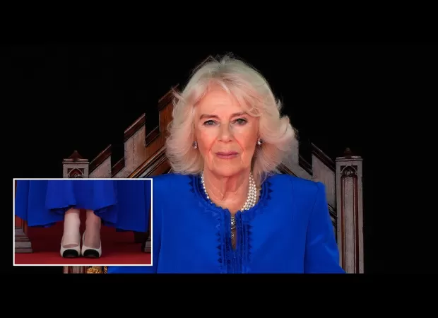 Queen Camilla is seen wearing a bandage on her foot, raising questions about her health and well-being.
