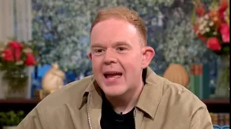 A young actor from Coronation Street reveals his hair transplant due to hair loss at the age of 22.