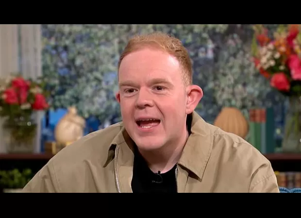 A young actor from Coronation Street reveals his hair transplant due to hair loss at the age of 22.