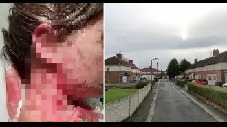 Child brutally attacked by unregistered aggressive XL Bully, sustaining serious injuries to neck and head.