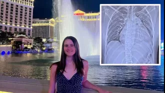 Woman suffers serious injury from horse kick, faces new challenge