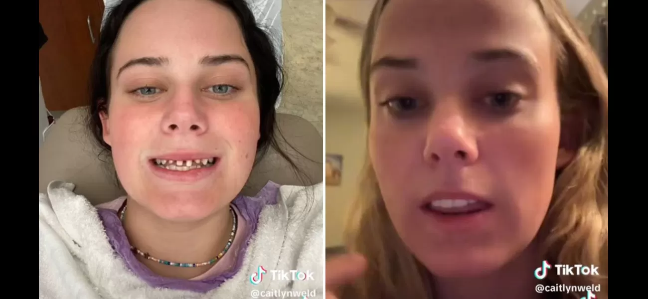A teen girl mistakenly got her teeth shaved off instead of a root canal at the dentist.