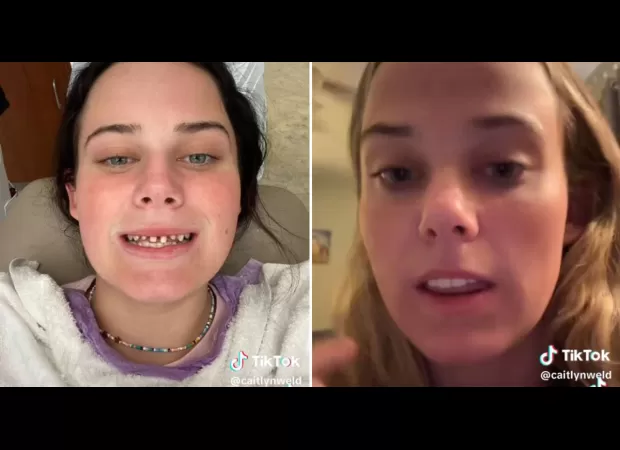 A teen girl mistakenly got her teeth shaved off instead of a root canal at the dentist.