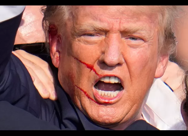 FBI confirms bullet hit Trump in failed assassination attempt.