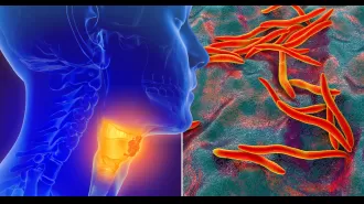 Researchers find bacteria that destroys nearly all cancer cells.