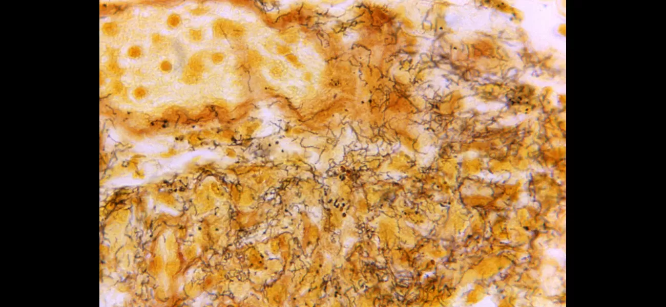 Australia is facing a pressing issue with a significant increase in cases of sexually transmitted infections.
