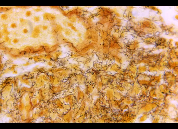 Australia is facing a pressing issue with a significant increase in cases of sexually transmitted infections.