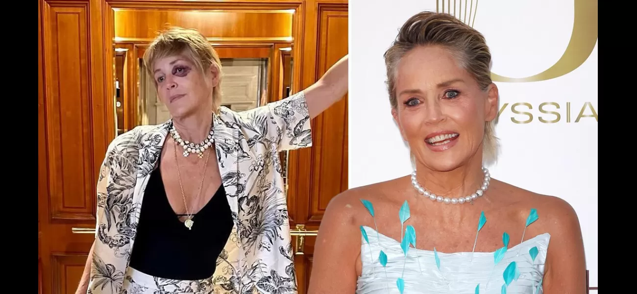 Actress Sharon Stone causes worry after sharing photo of bruised eye on vacation during difficult journey.
