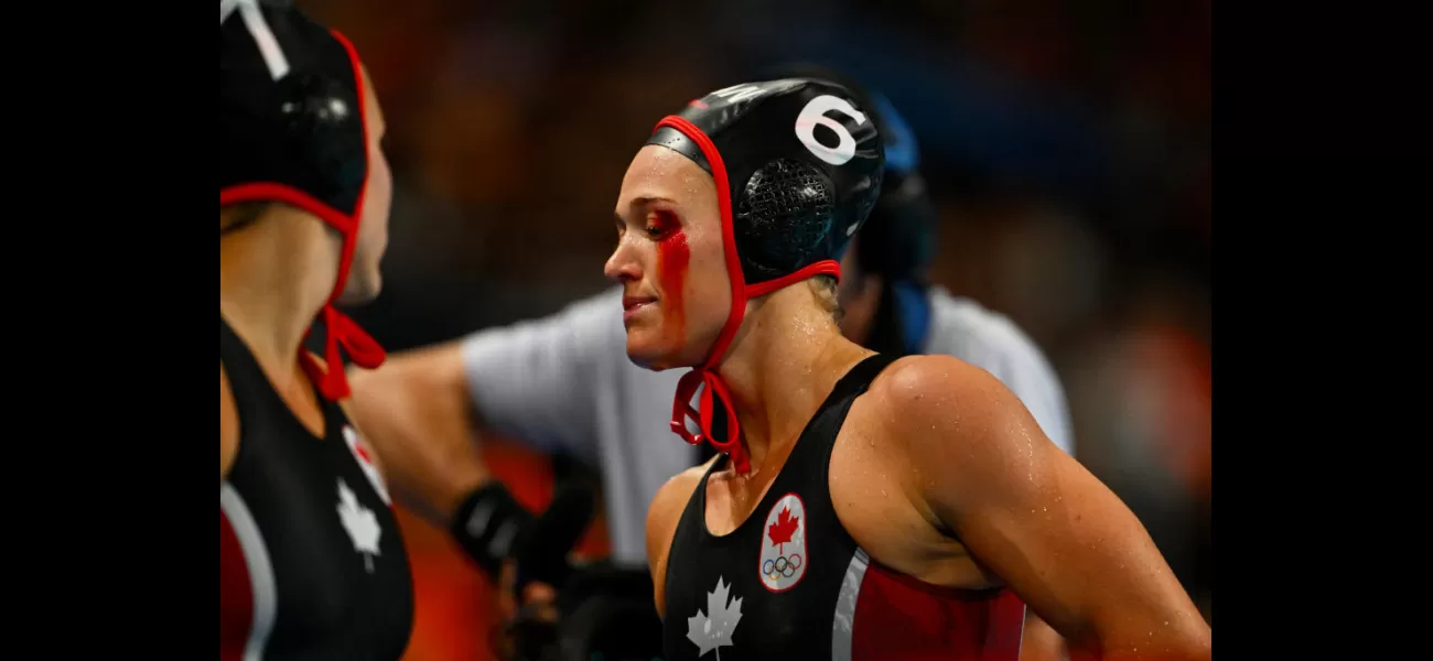 Water polo athlete injured in Olympics, resulting in bloody and gruesome eye injury.