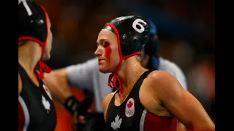 Water polo athlete injured in Olympics, resulting in bloody and gruesome eye injury.
