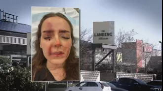 Woman undergoes surgery after being attacked in Perth pub by a person who threw a glass without any reason.
