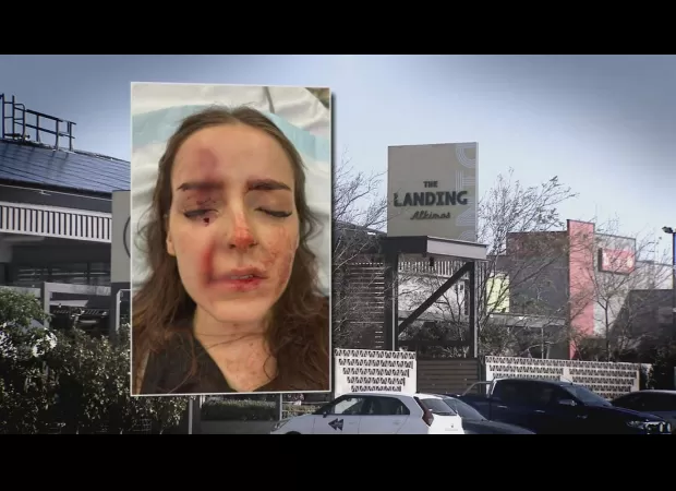 Woman undergoes surgery after being attacked in Perth pub by a person who threw a glass without any reason.