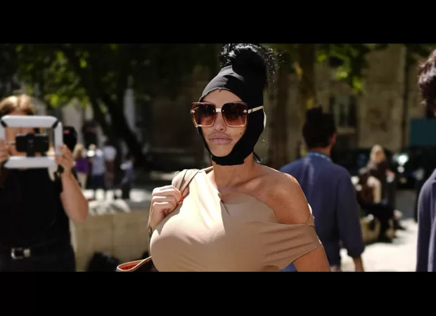 Katie Price shows off £10,000 facelift after Heathrow arrest.