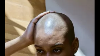 Towanda Braxton confidently embraces her alopecia and believes being bald is a wonderful thing.