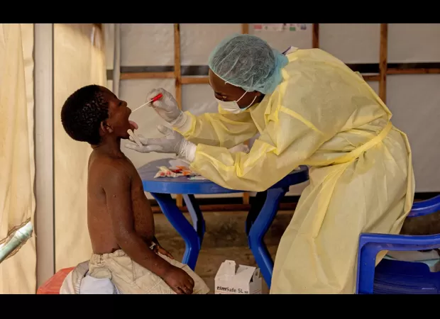 WHO has declared a global emergency due to Mpox.