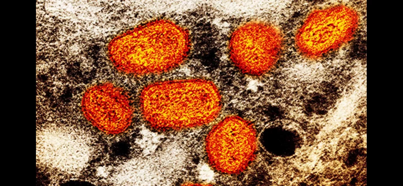 NSW sees surge in smallpox cases, prompting health warning.