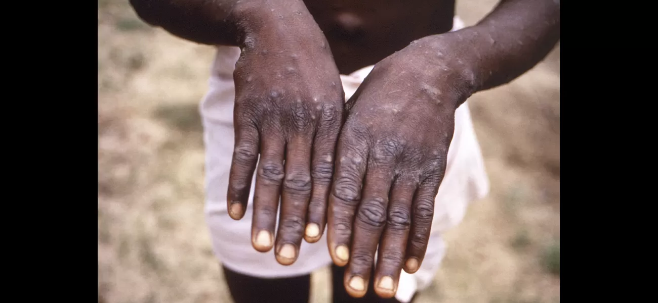 What is mpox and how can it be prevented?