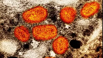 NSW sees surge in smallpox cases, prompting health warning.