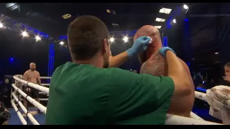 Fight cancelled after boxer loses part of his ear, leaving Anthony Joshua without an opponent.