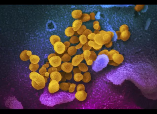 Australian economy loses $10 billion in one year due to long-term effects of COVID.