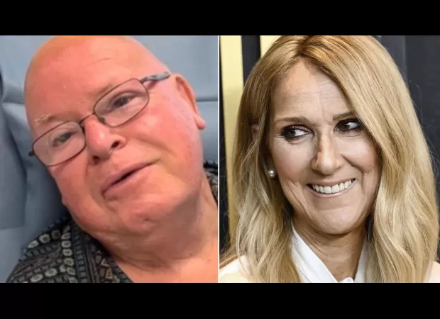 Rodney is a rare Australian with the same condition as Celine Dion.