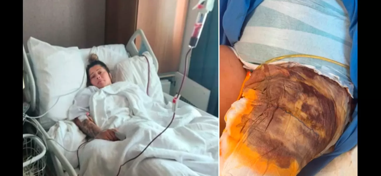 A mother from the UK suffered sepsis after a failed cosmetic surgery in Turkey. She had woken up during the procedure.