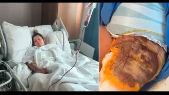 A mother from the UK suffered sepsis after a failed cosmetic surgery in Turkey. She had woken up during the procedure.