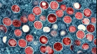 Thailand reports first case of contagious mpox in Asia.