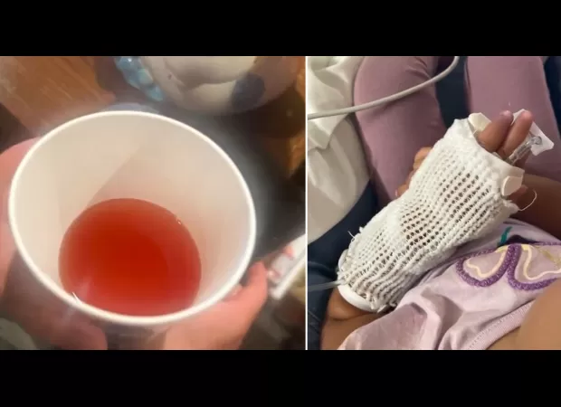 Young child accidentally served alcohol, experiences slurred speech and loss of balance.