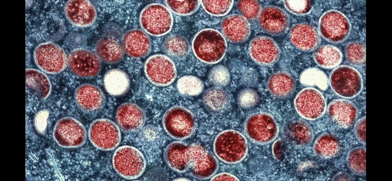 Travelers to Spain may have to deal with restrictions as mpox infection rates increase.