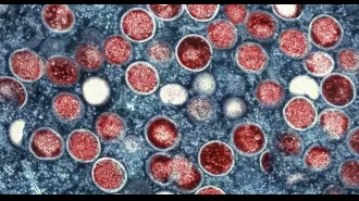 Travelers to Spain may have to deal with restrictions as mpox infection rates increase.