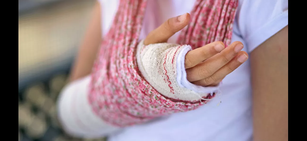 British people prefer to take care of their own injuries and create makeshift slings because they are afraid of long waits in hospitals.