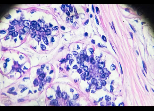 Pregnant women at higher risk of getting breast cancer, according to research.