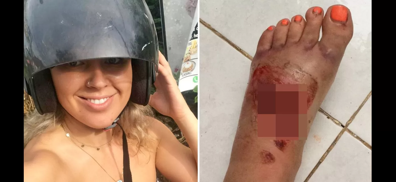 A British tourist was nearly left without a foot when they were impaled in a moped accident.