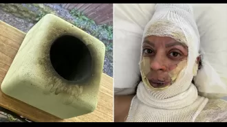 Mother's face burned off by portable fireplace explosion.