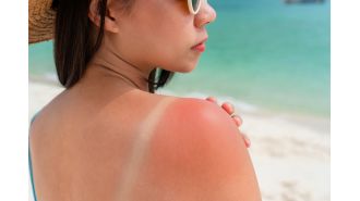 Most Australians don't use enough sun protection.