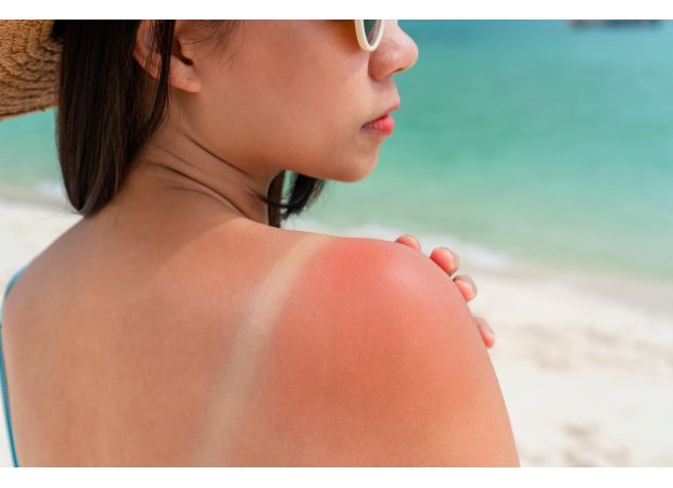 Most Australians don't use enough sun protection.