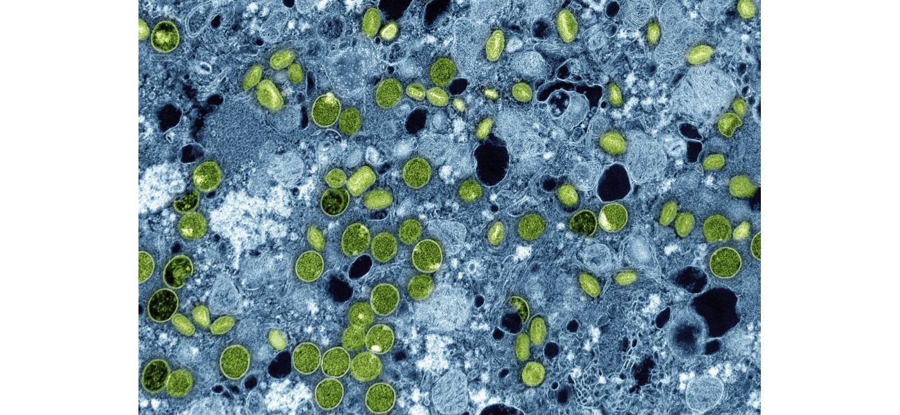 The disease MPOX is now present in a prison.