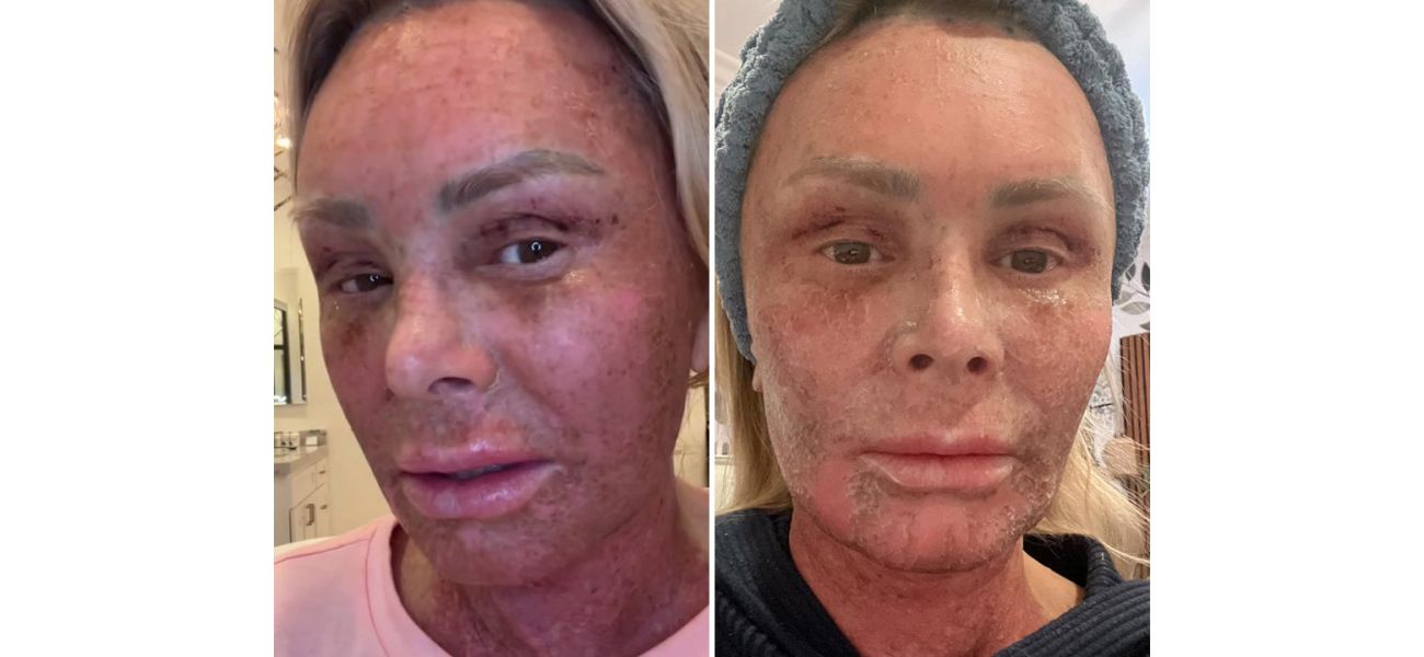 Famous actor shows off new face after major plastic surgery, looking 
