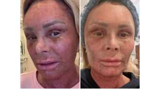 Famous actor shows off new face after major plastic surgery, looking 