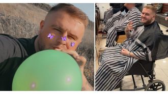 A man's hands were transformed into claw-like structures after regularly inhaling 500 laughing gas balloons per week.