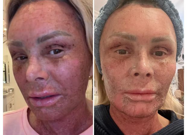 Famous actor shows off new face after major plastic surgery, looking 