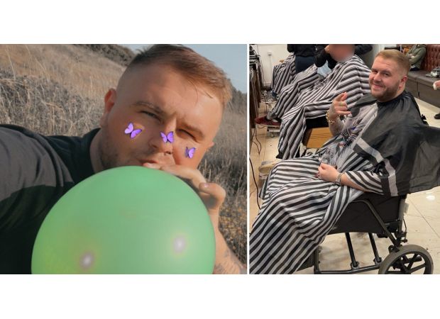 A man's hands were transformed into claw-like structures after regularly inhaling 500 laughing gas balloons per week.