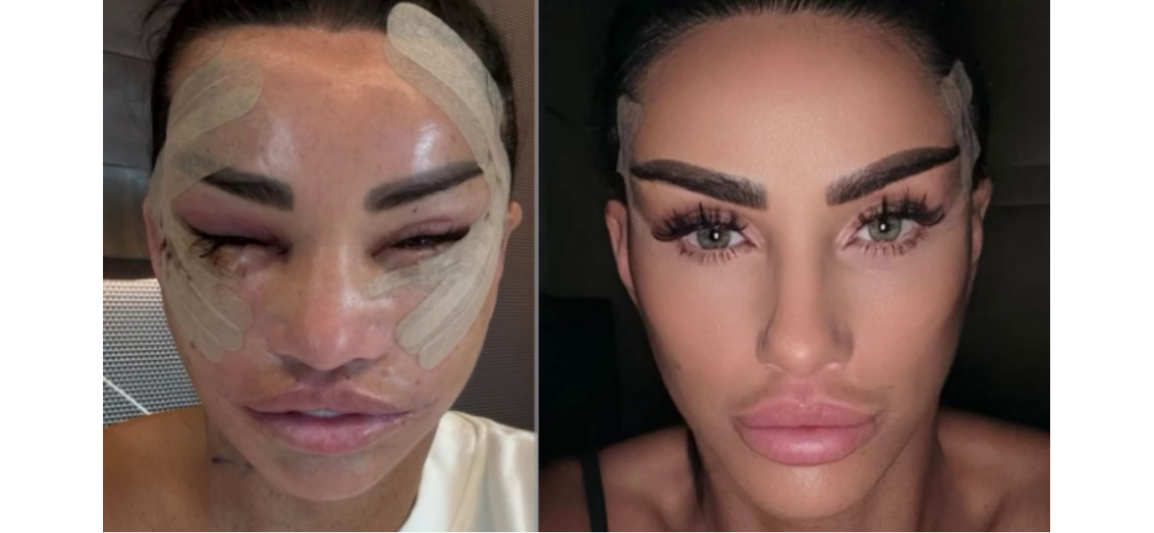 Katie Price advises followers to have faith in the journey by posting startling pictures of her healing from a facelift.