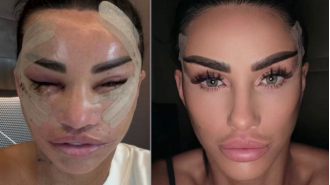 Katie Price advises followers to have faith in the journey by posting startling pictures of her healing from a facelift.