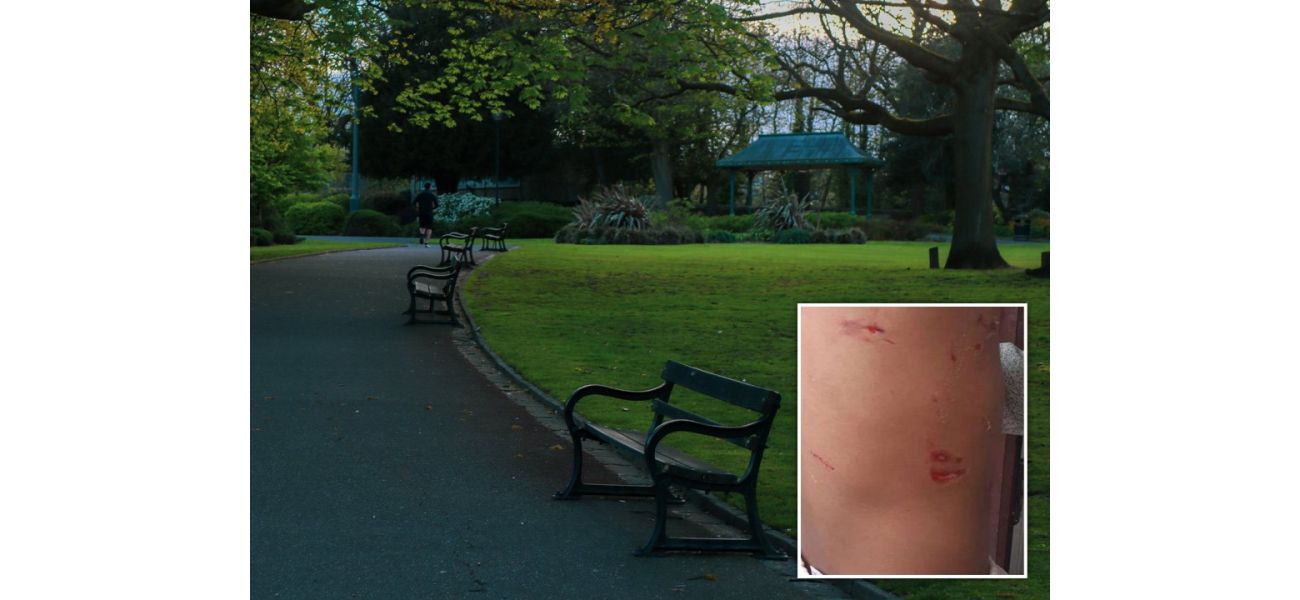 A 4-year-old girl was attacked by two large dogs, known as 