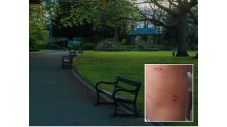 A 4-year-old girl was attacked by two large dogs, known as 