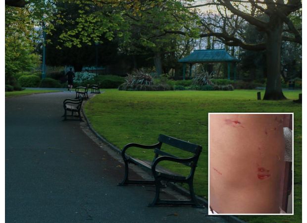 A 4-year-old girl was attacked by two large dogs, known as 